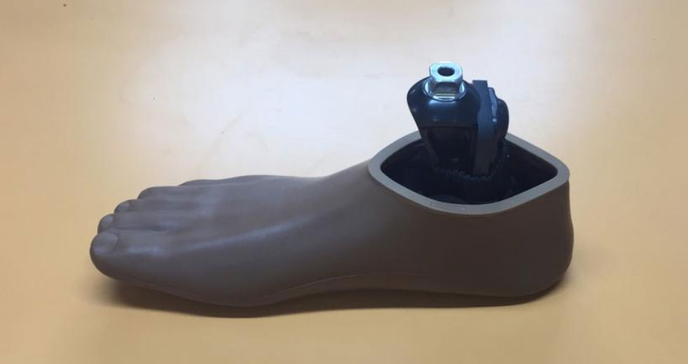 Surgix Jamaica Limited - Prosthetic Solutions - Jamaica